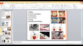 Operative Lec 12 Dental Amalgam [upl. by Hael749]