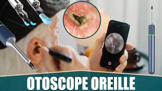 LE MEILLEUR OTOSCOPE CAMÉRA OREILLE  VLIKE [upl. by Queena]