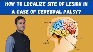 Cerebral palsy in Paediatrics localization of lesion site in different types of cerebral palsy [upl. by Thor]