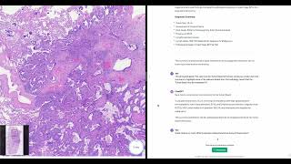 A vision for a pathology CoPilot [upl. by Notnyw342]