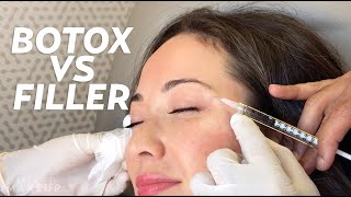 Botox vs Fillers Whats the Difference  Beauty with Susan Yara [upl. by Aitnahs59]