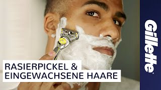 Eingewachsene Haare amp Rasierpickel Tutorial  Gillette ProShield [upl. by Buckler]