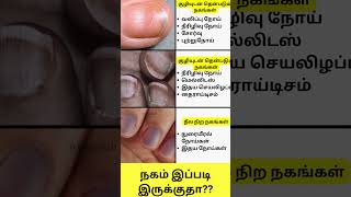 நகம் இப்படி இருக்குதா Nail Disorders in Tamil Shorts intamizh [upl. by Ennayllek]