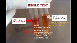 Indole test positive Indole test enterobacteria practical microbiology [upl. by Nnad]