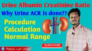 Urine ACR Principle amp Procedure with Calculation Labology [upl. by Primalia]