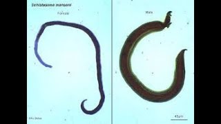 اسهل طريقة لشرح الشيستوسوماالبلهارسيا دودة الدمShistosomaBilharzia Blood flukeSchistosomiasis [upl. by Brahear]