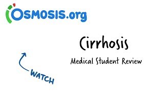 Cirrhosis Overview  Clinical Presentation [upl. by Britta293]