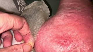 PEELING Sole Proprietorship HUGE PEEL ONE PIECE 13 VIDEOS December 21 2023 [upl. by Erda]