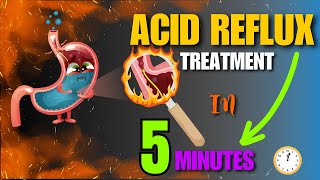 Effective Home Remedies For Acid Reflux  Natural Treatment At Home [upl. by Ignatius]