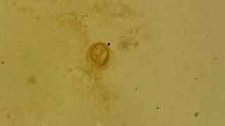 Fertilised decorticated egg of Ascaris lumbricoides [upl. by Ackerley]