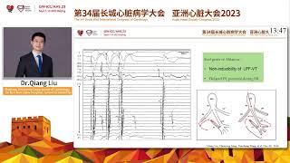 Left Posterior Fascicular VT and False Tendon at GWICCAHS 2023 [upl. by Melbourne]