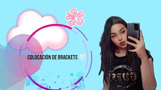 Mi proceso con la colocación de Brackets Estefania Beltran 💕 [upl. by Annairoc]