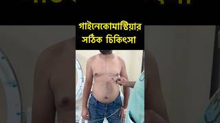 Gynecomastia Surgery  35k Campaign in Bangladesh  Gynecomastia Treatment [upl. by Eimmij]