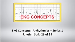 EKG Concepts Arrhythmias Course  Strip 26 of 39 [upl. by Assetal]