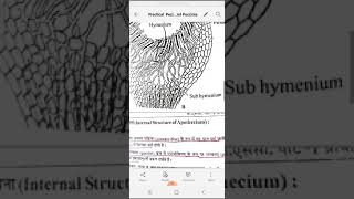 Practical Peziza Apothecium And Puccinia Vinita Singhal [upl. by Buckler]