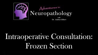 Intraoperative Consultation Frozen Section  Adventures in Neuropathology [upl. by Yance764]