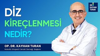 Diz kireçlenmesi nedir Belirtileri ve Evreleri Nelerdir Dizkireçlenmesi dizağrısı [upl. by Taimi]