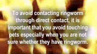 How Do You Get Ringworm [upl. by Spring]