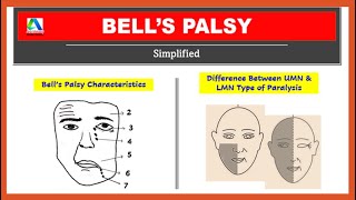 Bells palsy anatomy  upper and lower motor neuron paralysis  Simplified [upl. by Cleopatra]