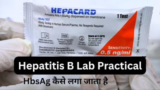 HBsAg test  Hepatitis B virus  Hepatitis B surface antigen test  Hepatitis B Practical [upl. by Elocen]