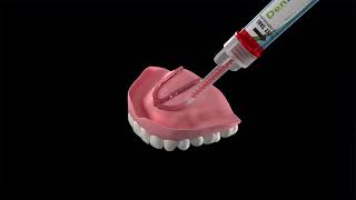 DenSureFit for Upper Denture [upl. by Yasmar]