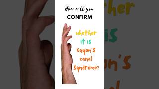 Confirmatory test for Guyon’s canal syndrome Froment’s test Ulnar tunnel syndrome shorts [upl. by Kareem]