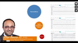 Ceribell EEG for Risk Stratification [upl. by Jere]