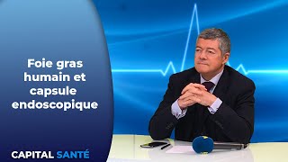 Foie gras humain et capsule endoscopique  Capital Santé [upl. by Alrrats]