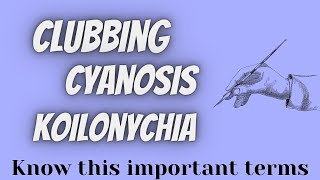 ClubbingCyanosisKoilonychia [upl. by Lawson504]