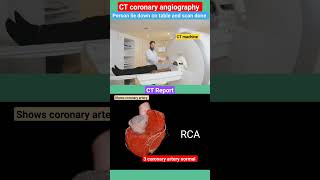 CT coronary angiography l heart coronaryartery shorts [upl. by Anafetse679]