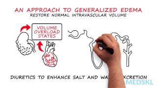 Nephrology – Generalized Edema By Timothy Yau MD and Michael Connor MD [upl. by Kistner]