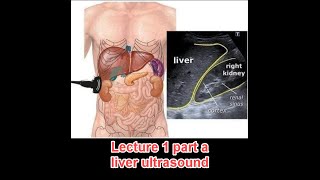 Abdominal ultrasound course  lecture 1 part a  liver د عمرو صلاح [upl. by Jaime834]