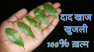 2 दिन में भयंकर से भयंकर दाद खाज खुजली को खत्म कर देगा  Fast Ringworm Treatment [upl. by Novahs]