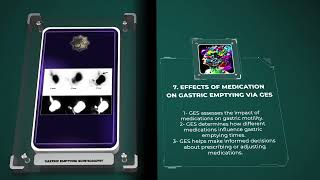 Gastric Emptying Scintigraphy [upl. by Sorips]
