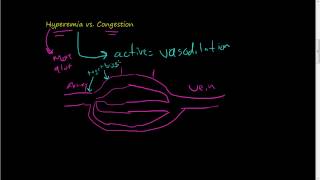 46Hyperemia vs Congestion [upl. by Teevens]