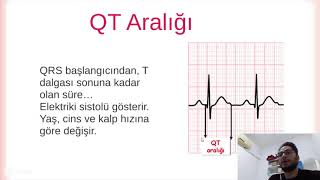 Temel EKG Okuma ve Yorumlama  Kolay ve Basit [upl. by Yeffej]