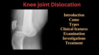 Knee joint dislocation Causes Types Clinical features Examination Investigations amp Treatment [upl. by Hannaj]