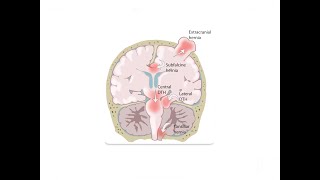 Understanding Kernohans Phenomenon  Central Nervous System  Internal Medicine [upl. by Enialb]