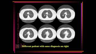 ultrasound radiologysonology [upl. by Sower270]