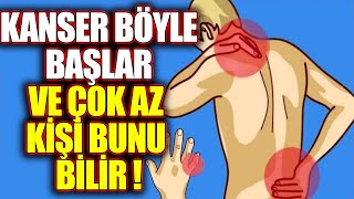 Kanser Olduğunuzu Gösteren 20 İşaret  Bu Belirtilerden Biri Bile Varsa Hemen Doktora Gidin [upl. by Duck207]