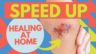 Wound Care How To Heal Faster At Home [upl. by Deni]