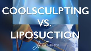 CoolSculpting vs Liposuction and Lipo360 [upl. by Jasik]