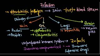 Pseudomonas aeruginosa infection [upl. by Kevin]