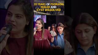 35 years of Psoriasis healed and cyst dissolved [upl. by Eimar]