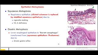 hypertrophy metaplasia [upl. by Venterea]