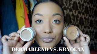 VITILIGO COVERAGE  DERMABLEND VS KRYOLAN MAKEUP [upl. by Constantina3]