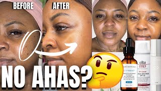 Treating Hyperpigmentation w SENSITIVE Skin SUCCESSFULLY Black Skin [upl. by Oznole]