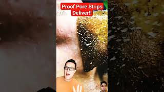 pore strips skincare science madaboutskin pores funfacts blackheads review didyouknow [upl. by Aigroeg]