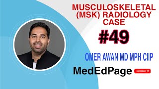 Musculoskeletal MSK Radiology CASE 49 [upl. by Aidualc891]