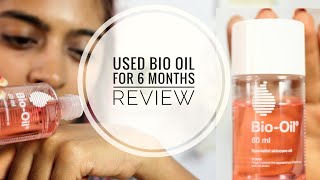 Bio Oil Review  Does Bio Oil Work on Stretch Marks amp Scars  SuperWowStyle [upl. by Anegal863]